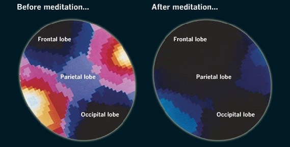 What meditation does to your brain