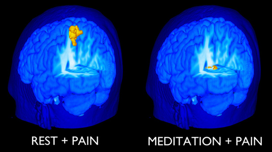 meditation reduces pain